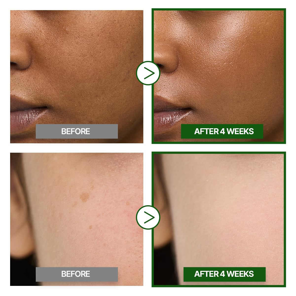 GOODAL Green Tangerine Vitamin C Cream Alpha – Brightening Moisturizer for Dark Spots