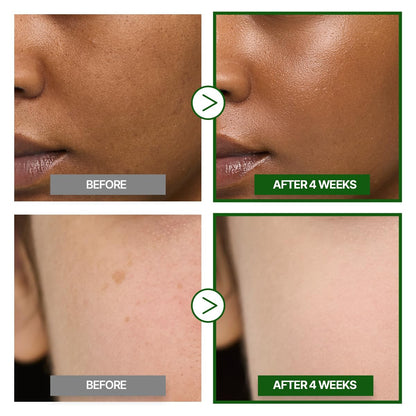 GOODAL Green Tangerine Vitamin C Cream Alpha – Brightening Moisturizer for Dark Spots